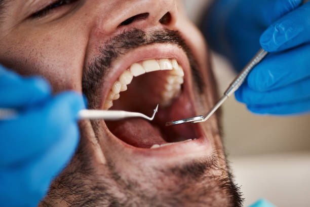 Best Dentist for Severe Toothache  in Ridgetop, TN