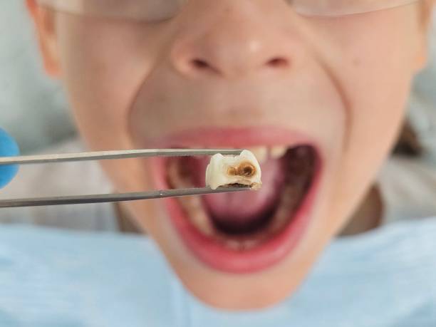 Best Tooth Infection Emergency Dentist  in Ridgetop, TN
